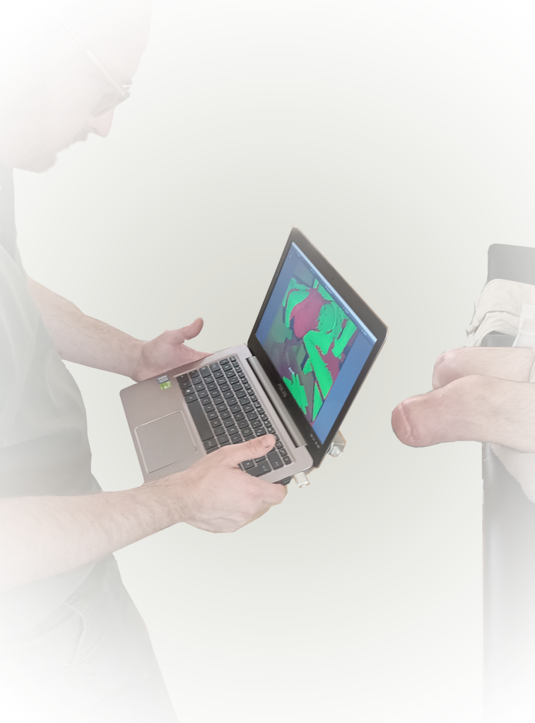 Scann 3D Amputation Tibiale Scann 3D d'une amputation Tibiale
